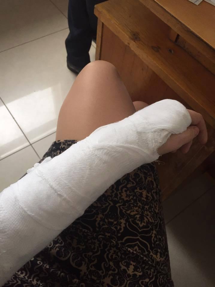 У Сєвєродонецьку на сесії міськради журналістці зламали руку