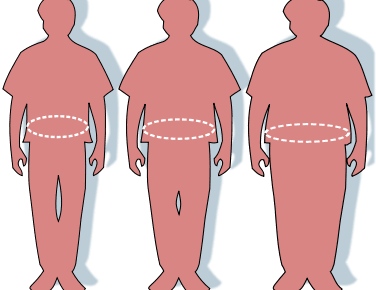 Близько 15% українців страждають на ожиріння, — лікар