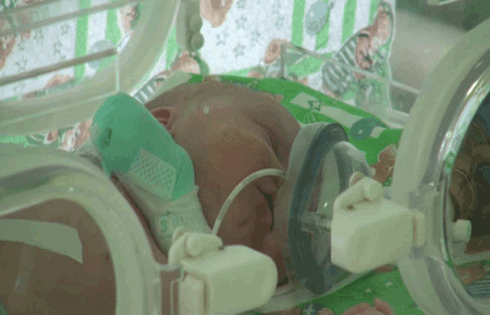 На Луганщині жінка залишила покалічену новонароджену дитину у під'їзді