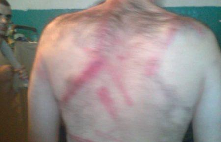 У дніпропетровському СІЗО нарахували два десятки травмованих