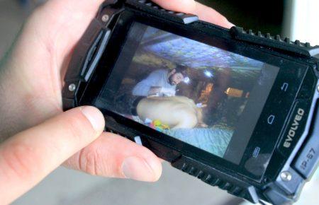 Гради падають, сиплеться земля, а ми в бліндажі оперуємо поранених, — військовий хірург про Дебальцеве