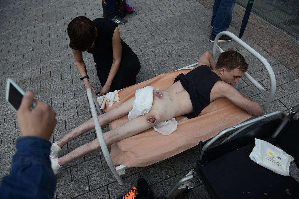 Мое тело — это Россия: акция против зверских наказаний в детдомах