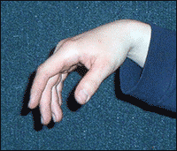 У столиці восьмикласник застрелився з батьківського револьвера