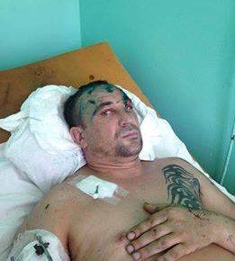 Під Запоріжжям бійця АТО побитого викинули з потягу