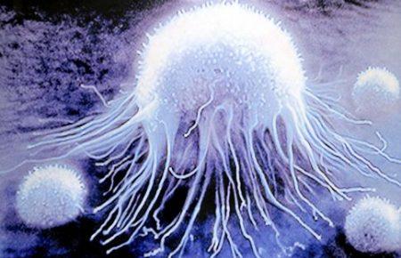 У 12 європейських країнах найчастіше помирають від раку