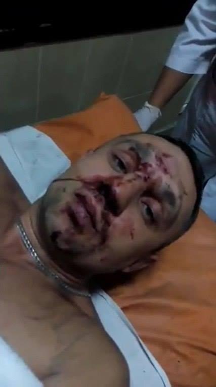 Якби не втік, живий не залишився б — учасник АТО про побиття у столиці