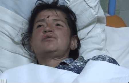 Поранена під час обстрілу в Авдіївці розповіла, як все сталося (ВІДЕО)