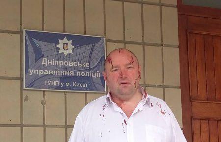 Юрист, який бореться з незаконними забудовами, заявив про напад на себе