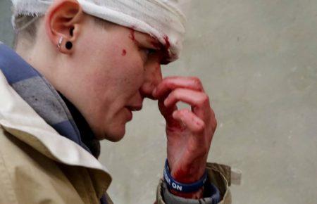 На Фестивалі Рівності дівчата напали на дівчину. Її забрала швидка, — журналістка (ФОТО, ВІДЕО)