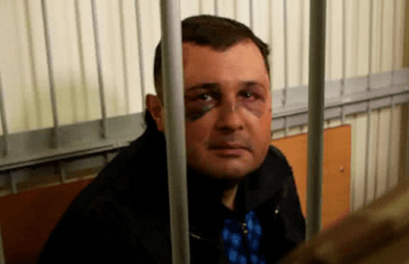 Хто побив екс-нардепа Шепелєва? Коментують СБУ та прокуратура