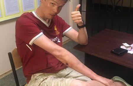 Поліція знайшла зниклого напередодні вболівальника