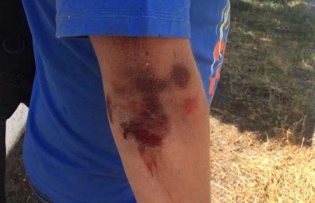 Журналіст з Херсона заявляє про побиття (ФОТО)