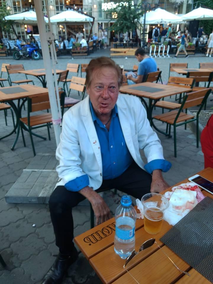 В Одесі побили учня Френка Сінатри Біллі Уоррена (ОНОВЛЕНО)