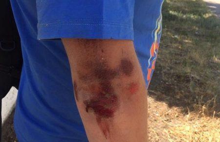 Нападів на журналістів побільшало з наближенням виборів - Оксана Романюк