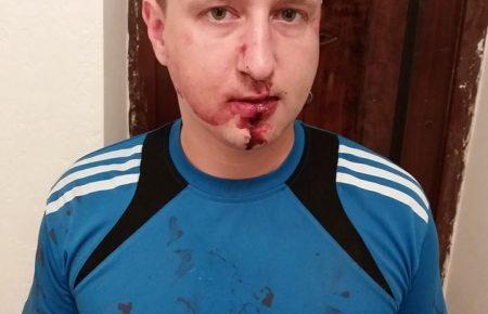 В Одесі пограбували журналіста