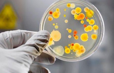 На Волині 5 людей захворіли на сальмонельоз після обіду в одному кафе