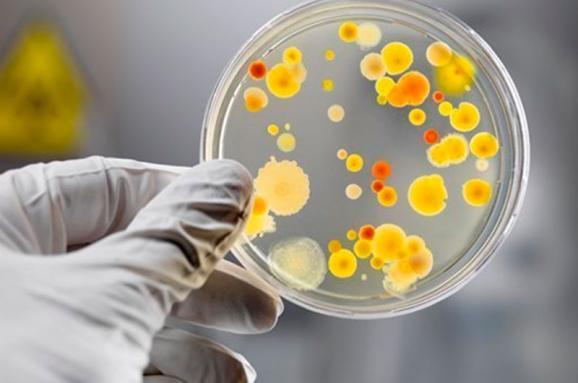 На Волині 5 людей захворіли на сальмонельоз після обіду в одному кафе