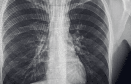 На Полтавщині засудили чоловіка, який проковтнув викрадену каблучку