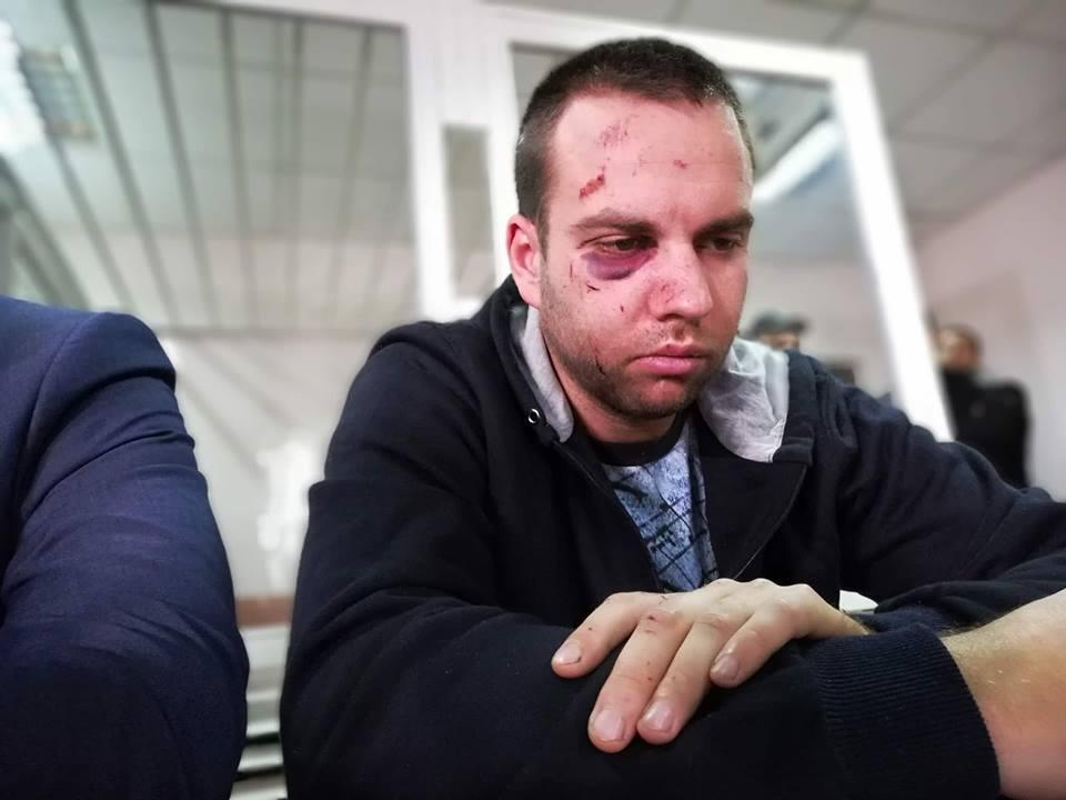 Підозрюваного у вчиненні смертельної ДТП в Одесі арештували на два місяці