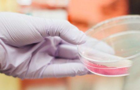 У школі на Одещині на гепатит «А» захворіли четверо дітей — МОЗ