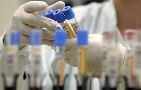 Україна за потреби надсилатиме до лабораторії в Лондоні матеріали для тестування на коронавірус