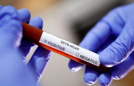 Через пандемію коронавірусу 25 мільйонів людей можуть втратити роботу