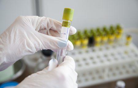 Мужчина, умерший от COVID-19 в Тернопольской области, ранее контактировал со священником, у которого также зафиксировали коронавирус — Геращенко