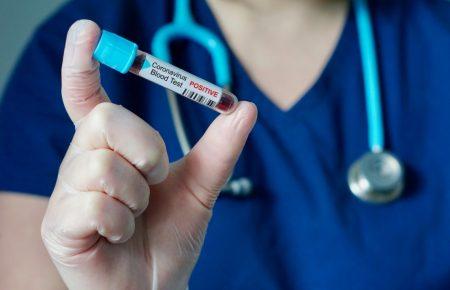 На Київщині зафіксували 64 випадки коронавірусу