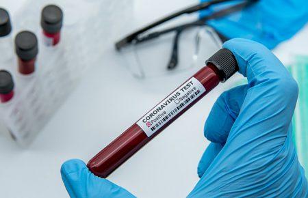 В Україні різко зросла кількість нових випадків COVID-19 — 1106 за минулу добу