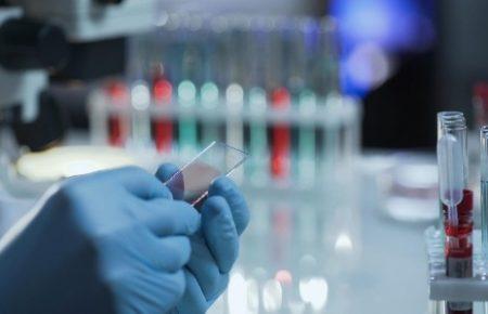 COVID-19: антитела сохраняются минимум 4 месяца, при повторном заражении болезнь может протекать тяжелее — исследование