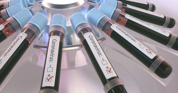 Хибнонегативних ПЛР-тестів на COVID-19 близько 30%, а хибнопозитивних — лише близько 1% — епідеміологиня