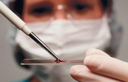 Густа кров при COVID-19 — це міф — терапевтка 