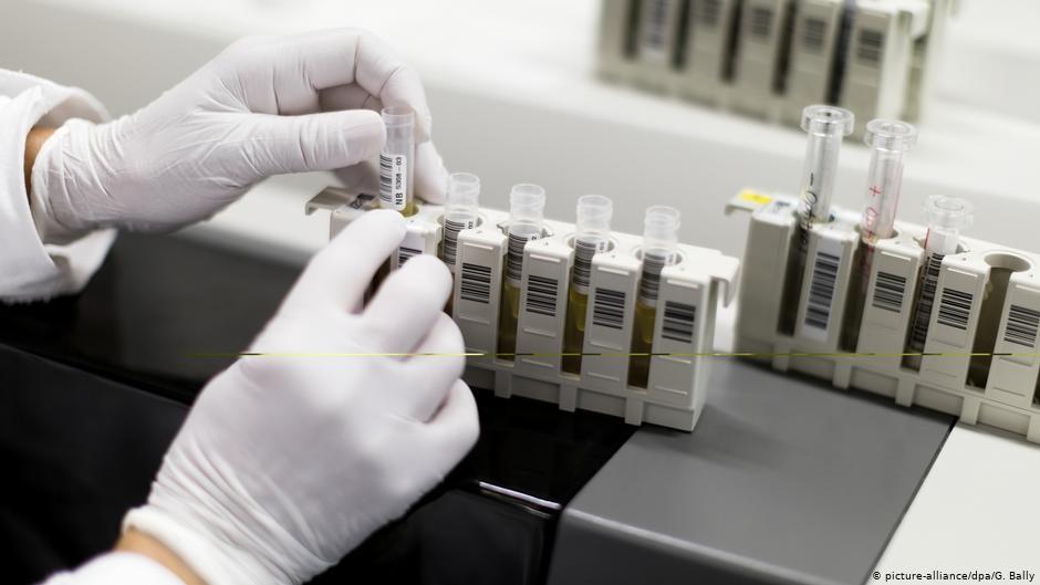 Био-поведенческое исследование даст больше информации о распространении ВИЧ в группах риска — Нестерова