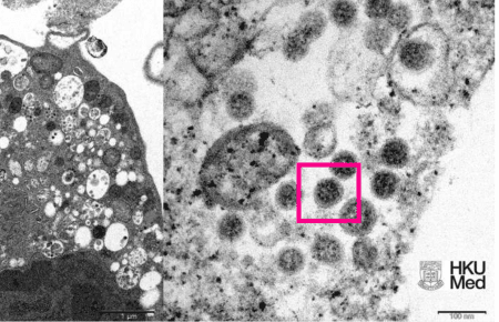 Вчені показали перше фото штаму «Омікрон»