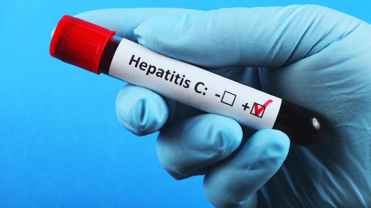 За пів року на гарячу лінію з питань вірусних гепатитів надійшло понад 900 звернень — лікарка-інфекціоністка 