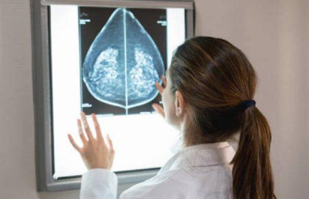 Онкохірургиня: Кожні 40 хвилин в Україні виявляють одну жінку, хвору на рак молочної залози