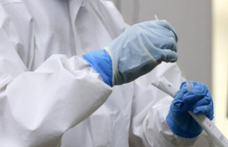 Твіндемії в Україні поки що немає, але вона може статися — Лапій про можливість одночасної епідемії COVID-19 та грипу