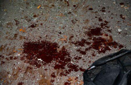 Обстріл центру Херсона: один із потерпілих — у важкому стані