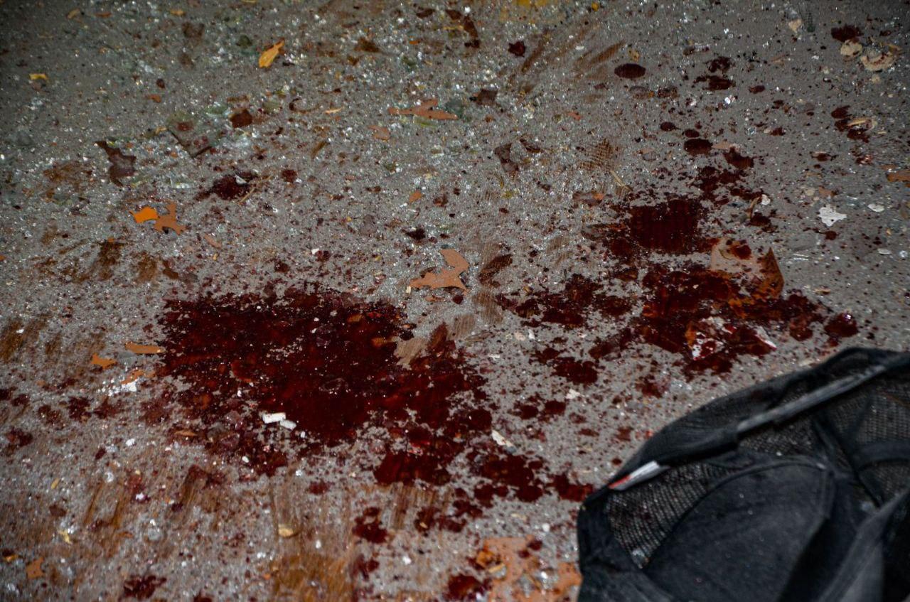 Обстріл центру Херсона: один із потерпілих — у важкому стані