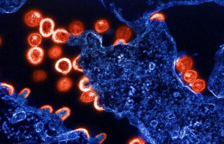 Дослідники виявили генетичний варіант, що обмежує розмноження ВІЛ