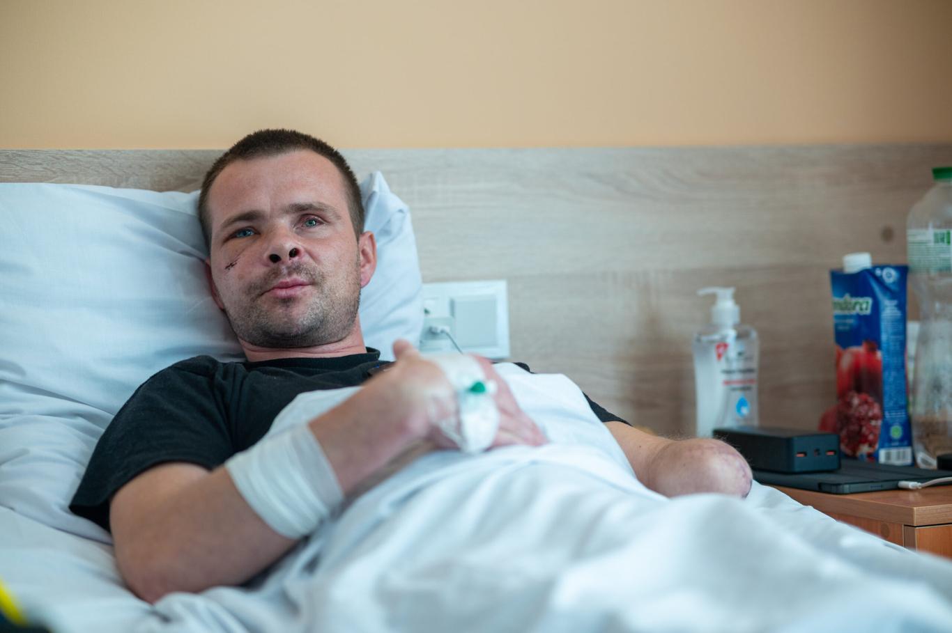 «Зроблю протез — і на фронт»: історія морпіха Фенікса