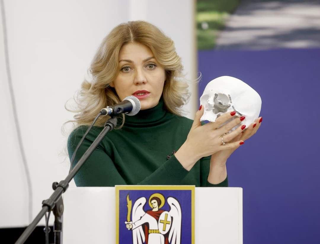 Для захисників і захисниць це непосильні кошти — волонтерка про операції на обличчі