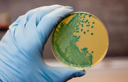 Cтійкі до ліків бактерії можуть поширюватися від людей до диких тварин