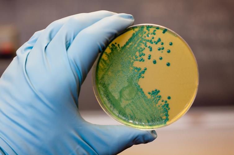 Cтійкі до ліків бактерії можуть поширюватися від людей до диких тварин