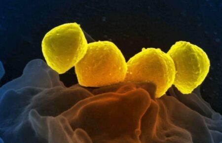 У Японії зафіксували спалах смертельної бактеріальної інфекції
