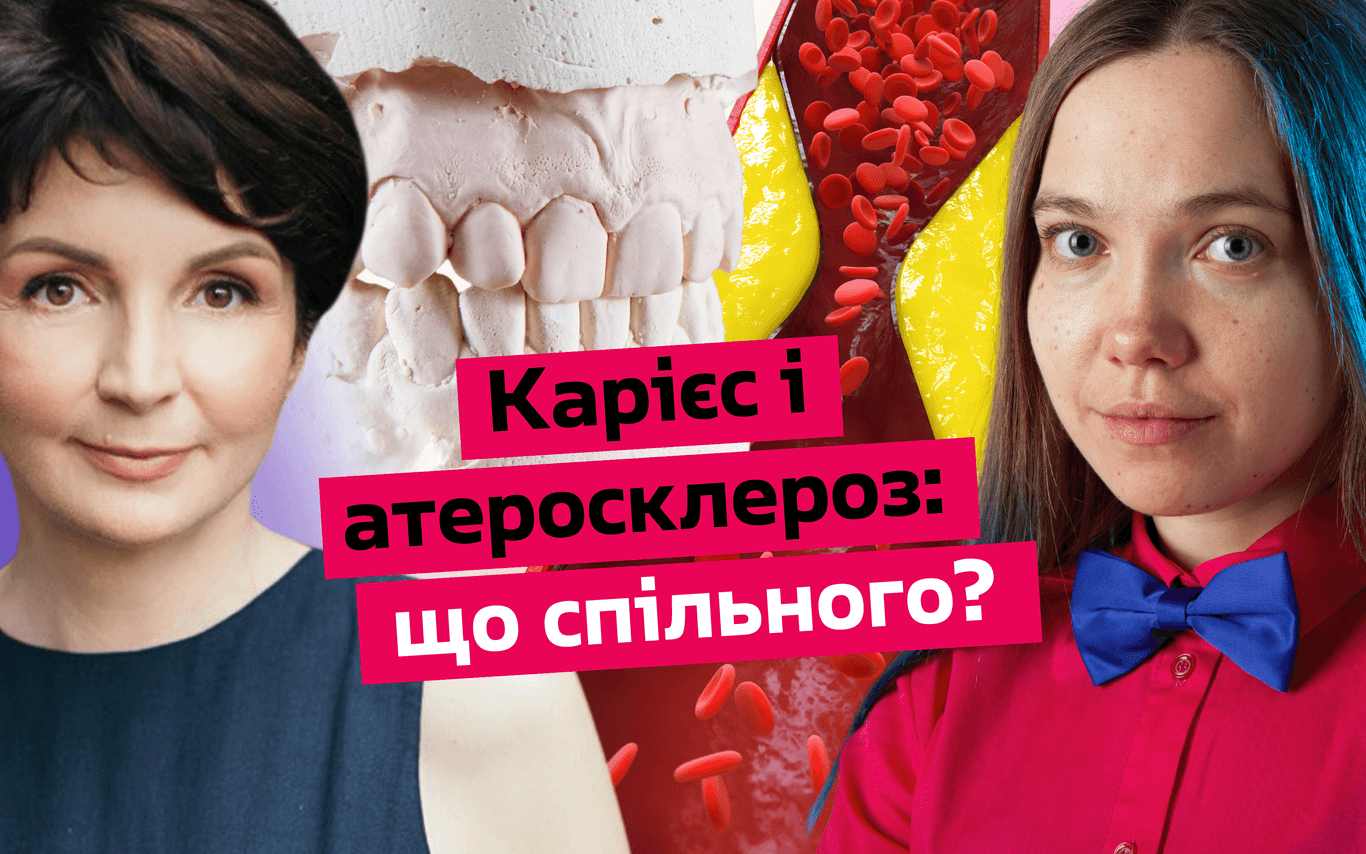 Серцево-судинні захворювання і карієс: який звʼязок