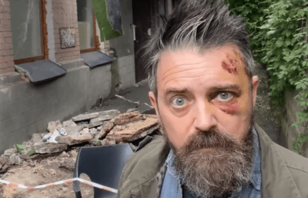 Американський режисер постраждав від падіння балкона в Києві