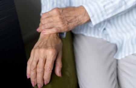 Хвороба Паркінсона починається за 15 років до симптомів, — лікар-невролог