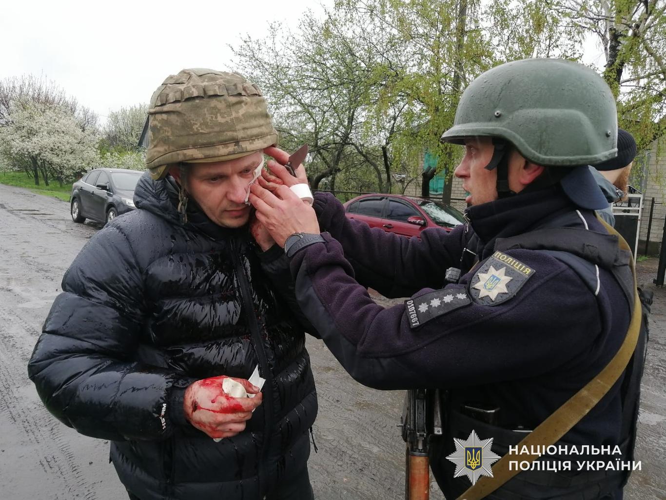 Чоловік кинув дві гранати в поліцейських під час затримання на Дніпропетровщині, є поранені