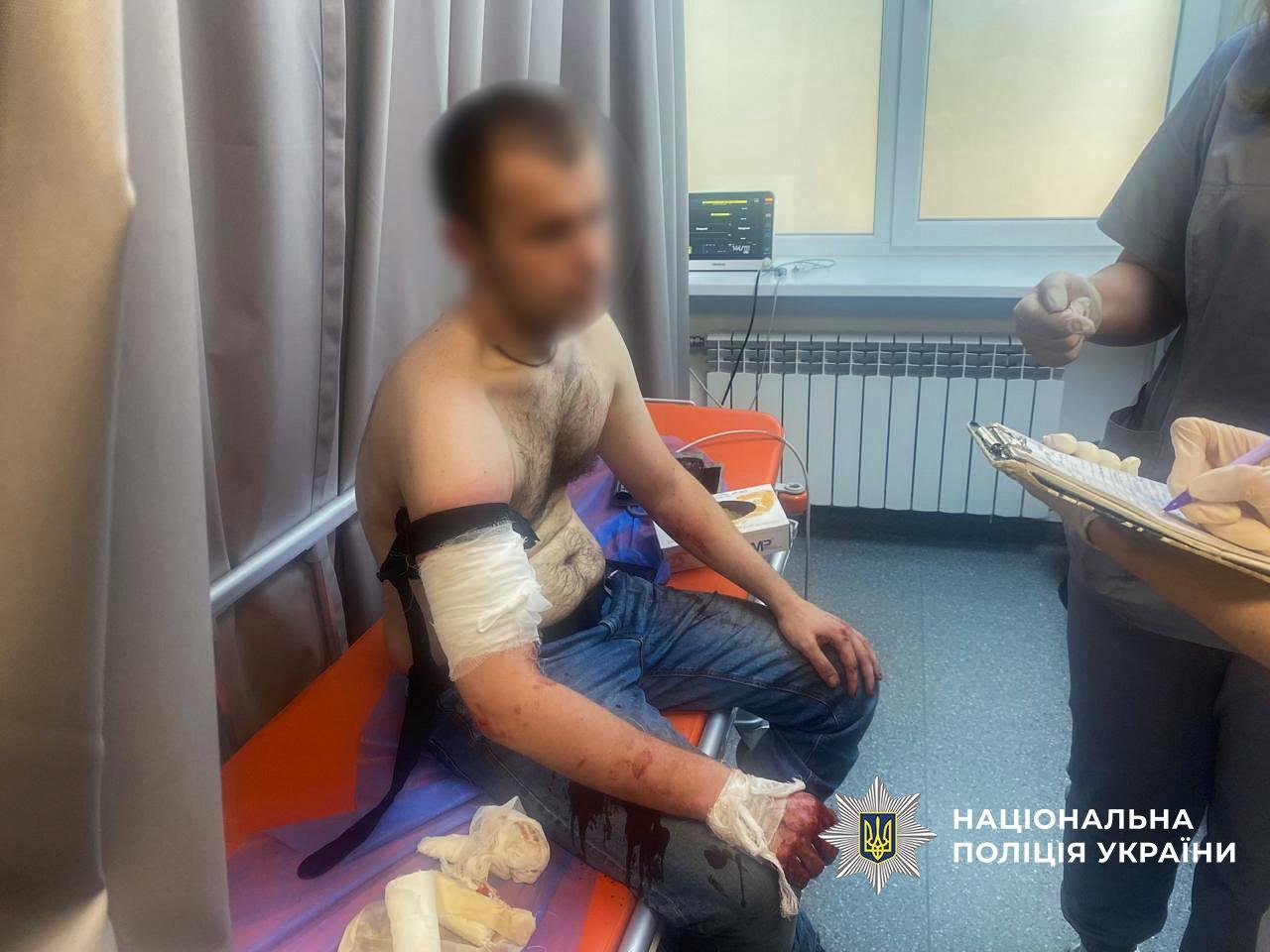 Поліцейські застрелили чоловіка, який напав на них з ножем у Запоріжжі